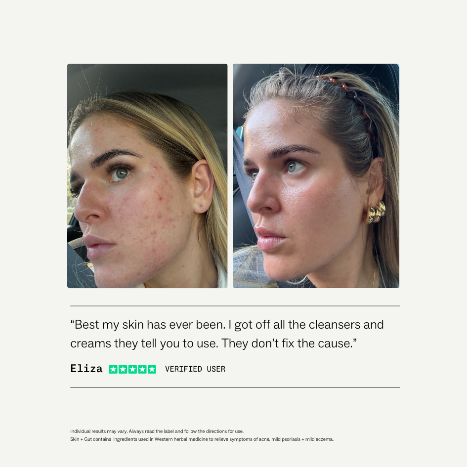 My Way Up Skin + Gut